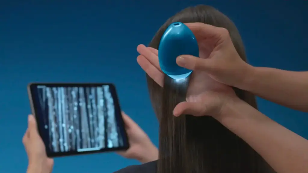 Hair Loss and Scalp Care